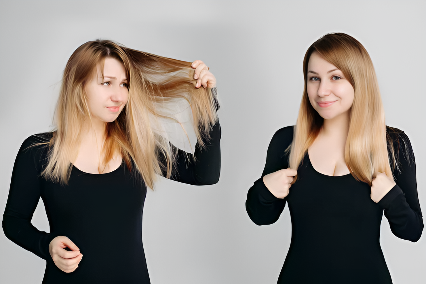 Before and After Hair Transplant