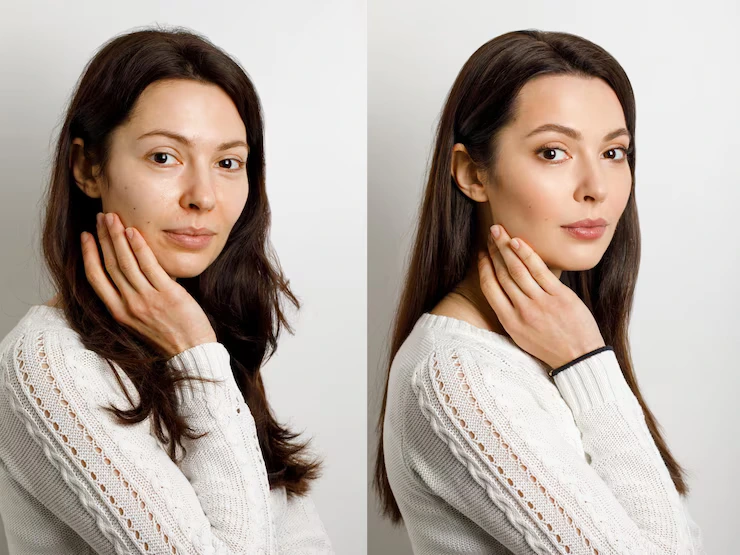 Before and After 4
