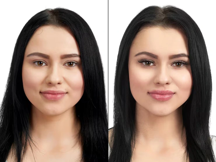 Before and After 6