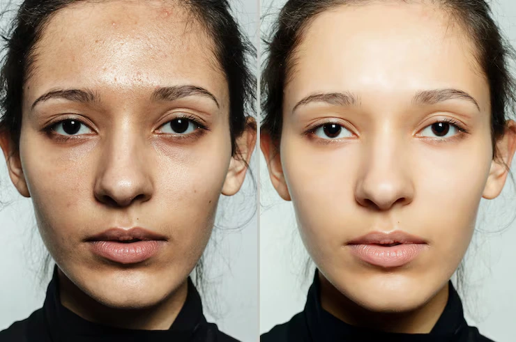 Before and After 7