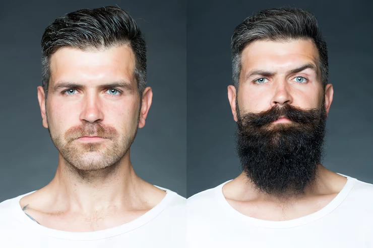 Before and After 9