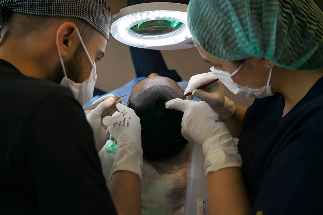 Hair Transplant Procedure