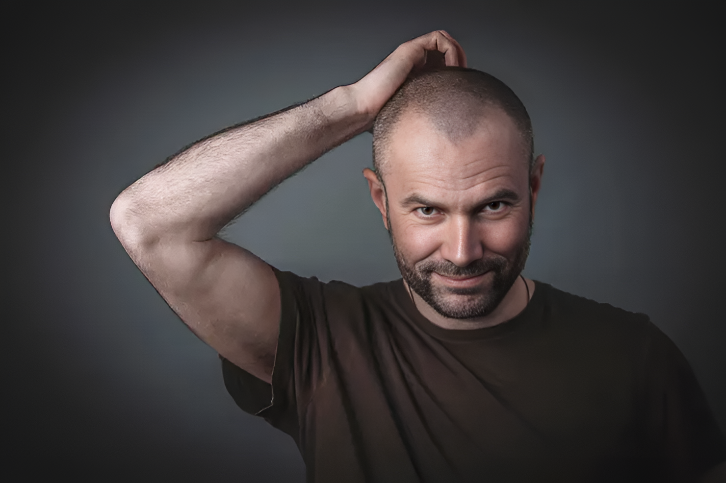 Hair Transplant Procedure