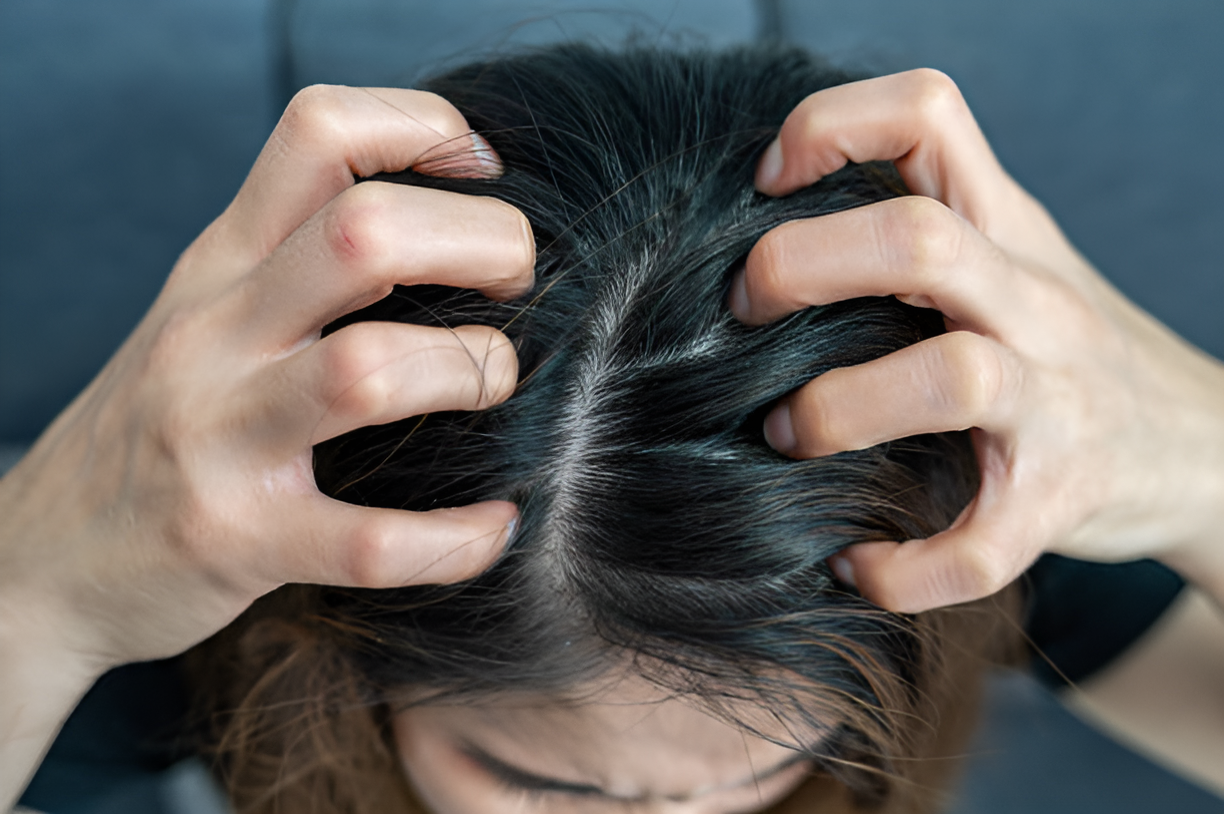Hair Transplant Procedure
